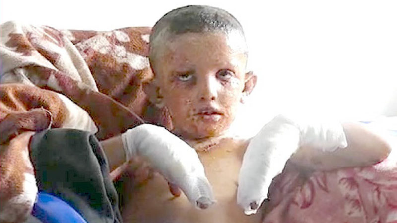 Erdogan’s war crimes: the truce broken by Turks with 18 dead. White phosphorus against children