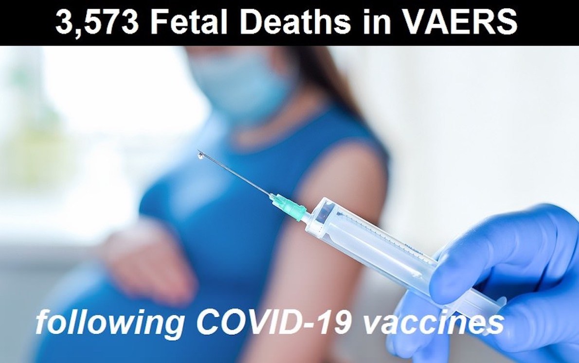 3,573 Fetal Deaths in VAERS Following COVID-19 Vaccines: 1,867% Increase Over Non-COVID Vaccines