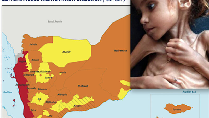 Worse than Ukraine! In Yemen “Catastrophic” Hunger due to Saudi War: 400,000 Toddlers at “Risk of Death”