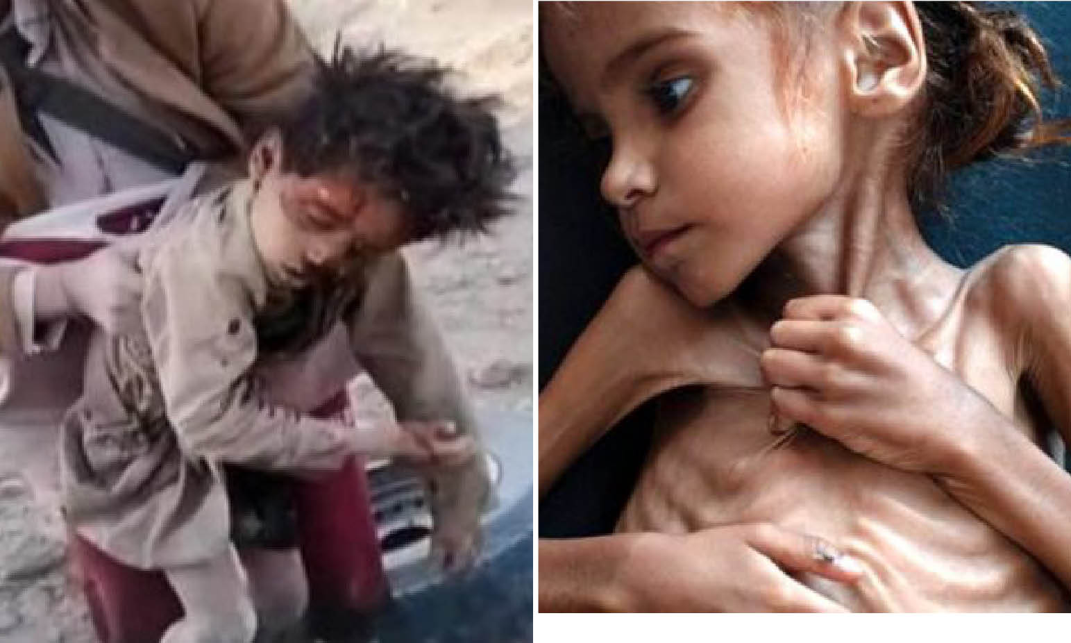 Yemen: 19 Children Massacred by Saudi Airstrike on Retaliation for Downed Tornado