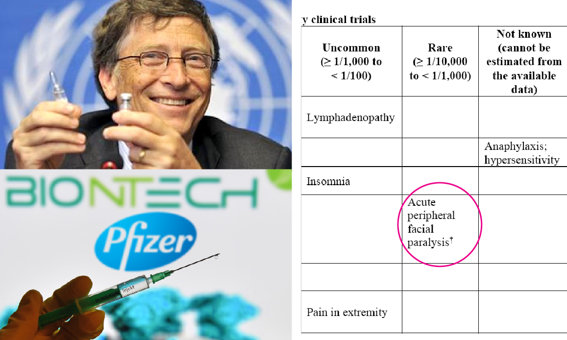 Pfizer Vaccine as Russian Roulette: Inefficacy, Facial Palsy and Anaphylaxis’ Risks. Italians Physicians’ Uprising. German Vaccinated Nurses’ Overdose