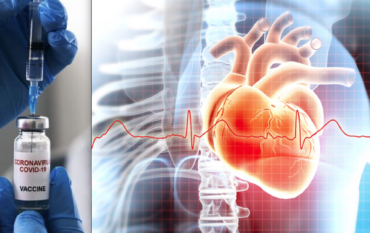 Risk of Acute Coronary Syndrome Dramatically Increases after mRNA Covid Injections, a new Study finds