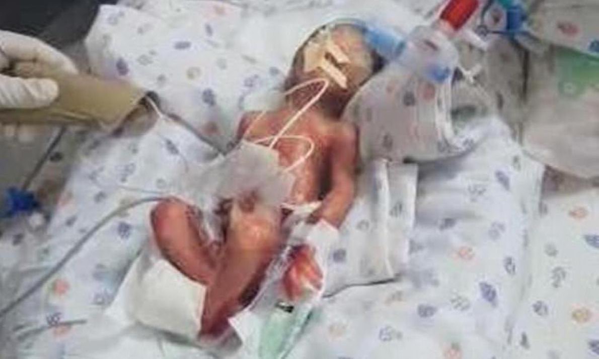 Fully Vaccinated Mother Gives Birth To Baby Bleeding From Nose and Mouth. Newborn Dies Day Later