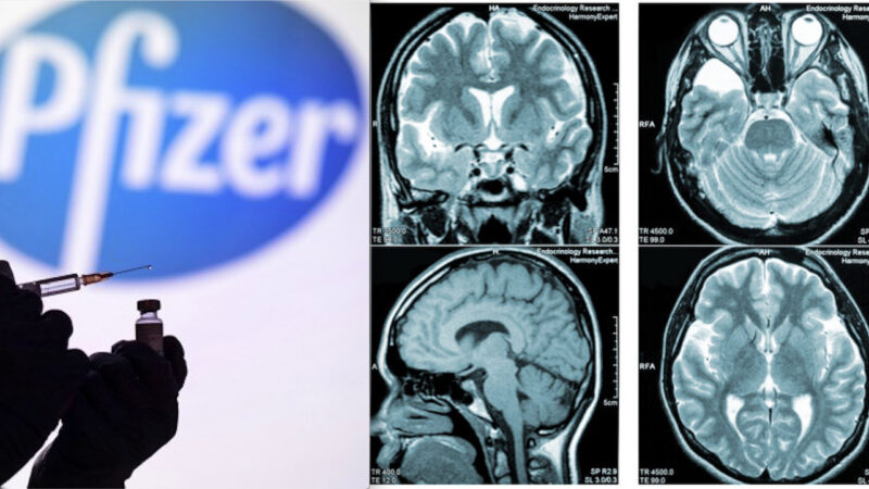 Brain Damages after COVID mRNA Vaccines: Pfizer Knew of 44,000 Injured since 2020! Study confirms Alert already launched by CDC and FDA