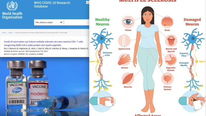 Vital! “Covid-19 mRNA Vaccination can Induce Multiple Sclerosis”. University Hospital Zurich and WHO Warning! 273 Cases in VAERS Adverse Reactions