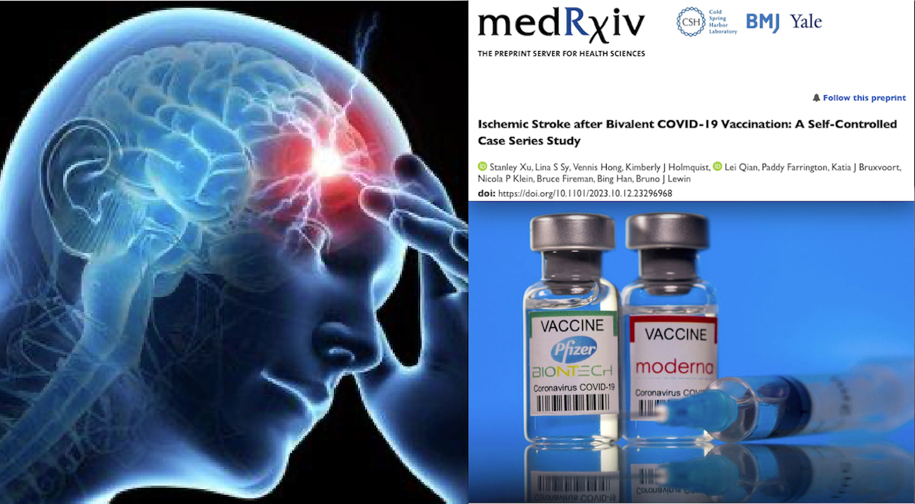 Exclusive! “Stroke High Risk with Covid mRNA Vaccine alongside with the Flu One”. Big Pharma Scientists in a NIH funded Study