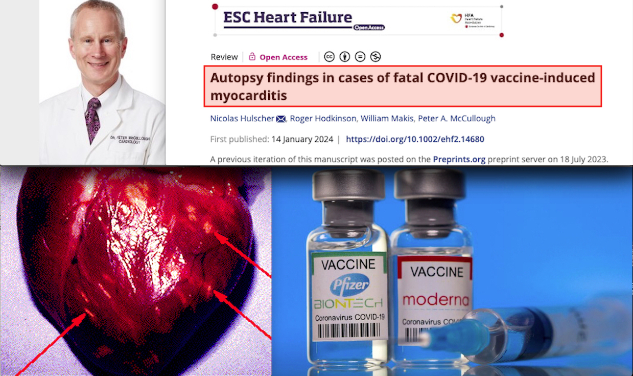 Myocarditis: Massacre after mRNA Vaccines! Other 28 Deaths Confirmed by Autopsies (Study), 18,000 Adverse Reactions, 10,000 Mysterious Heart Attacks