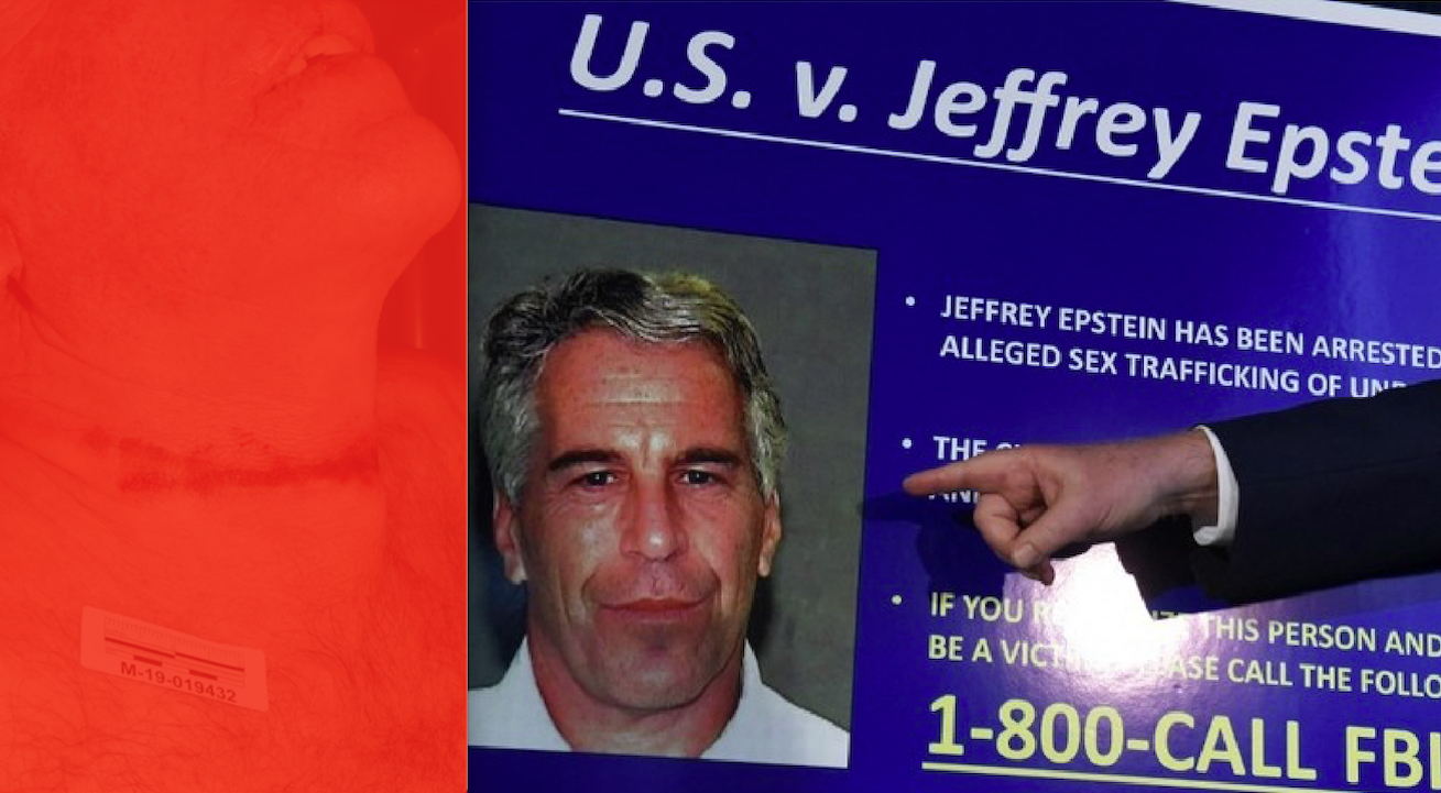 “New Jeffrey Epstein Autopsy Photo proves he didn’t Kill Himself” his Brother said. Warning: Chilling Photo