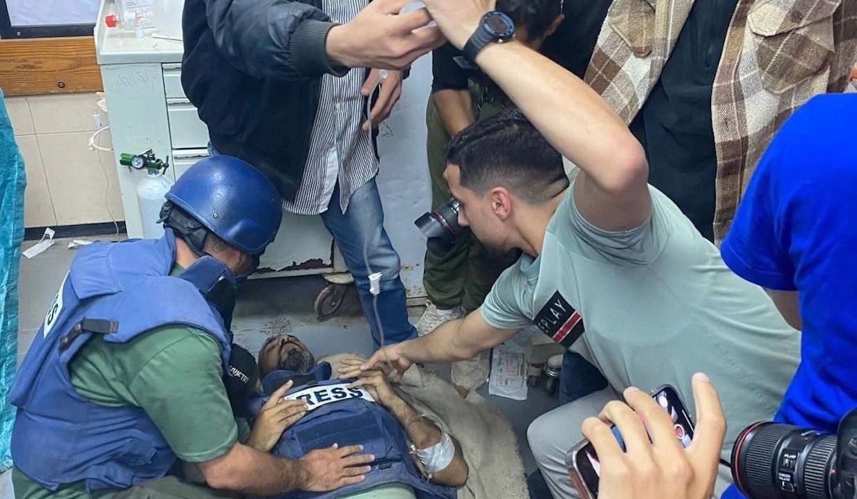 Israeli and Ukrainian Zionist Regimes systematically Target Journalists. Leg Amputated to one of them