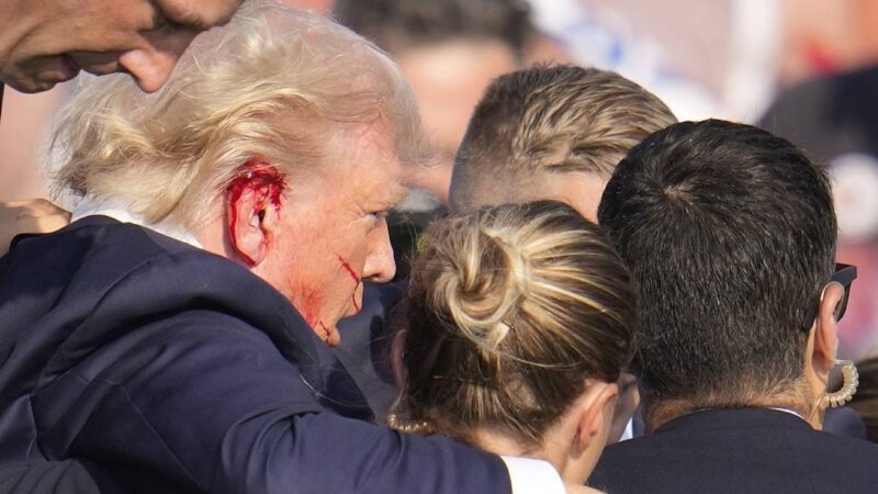 FBI confirms Trump’s BULLET Wound. “No Evidence that the former US president was hit by anything other” his physician has stated