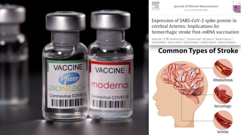 BREAKING STUDY — COVID mRNA Injection SPIKE Protein inside Cerebral Arteries of STROKE Patients for Up to 17 Months