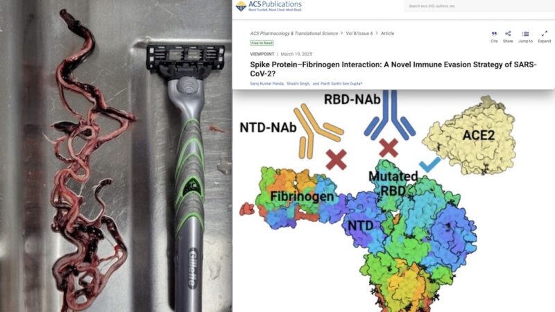Embalmer Survey: KILLERS “CALAMARI” of BLOOD CLOTS raise after mRNA Covid Vaccination linked to Toxic Spike-Fibrin interactions of SARS-Cov-2 BioWeapon