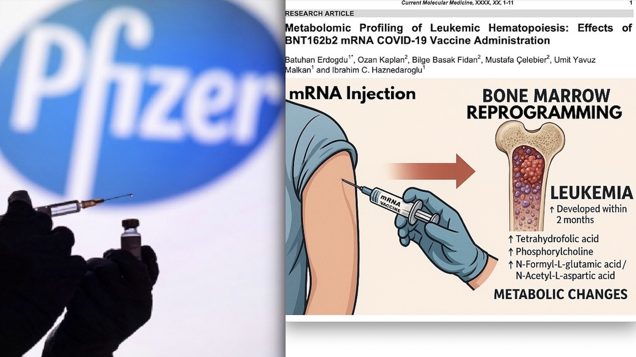 BREAKING: mRNA Shots Induce Cancer-Linked Bone Marrow Reprogramming Within Weeks altering Metabolic Pathways in Leukemia