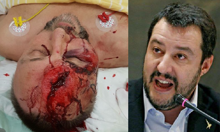 TENTATO OMICIDIO POLITICO AL “SALVINI” TEDESCO