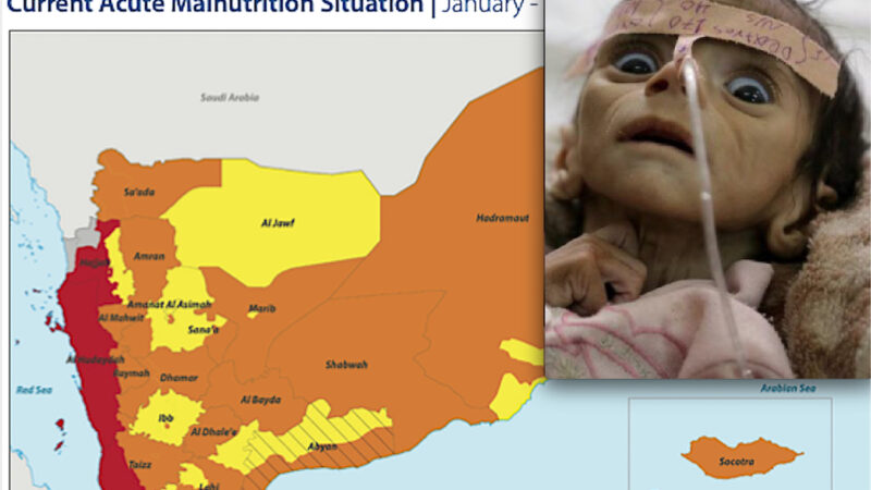 BIMBI IN GUERRA: YEMEN PEGGIO DELL’UCRAINA! 400mila Neonati a rischio di Morte Imminente per Fame. Dopo Bombe Italiane