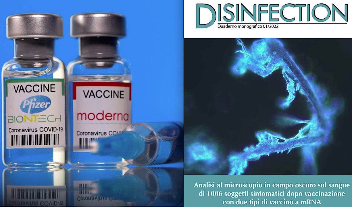 VACCINI & GRAFENE – 6. “NANOPARTICELLE TOSSICHE NEL SANGUE DEL 94 % DI 1.006 VACCINATI”.  Studio Shock di 3 Chirurghi Italiani