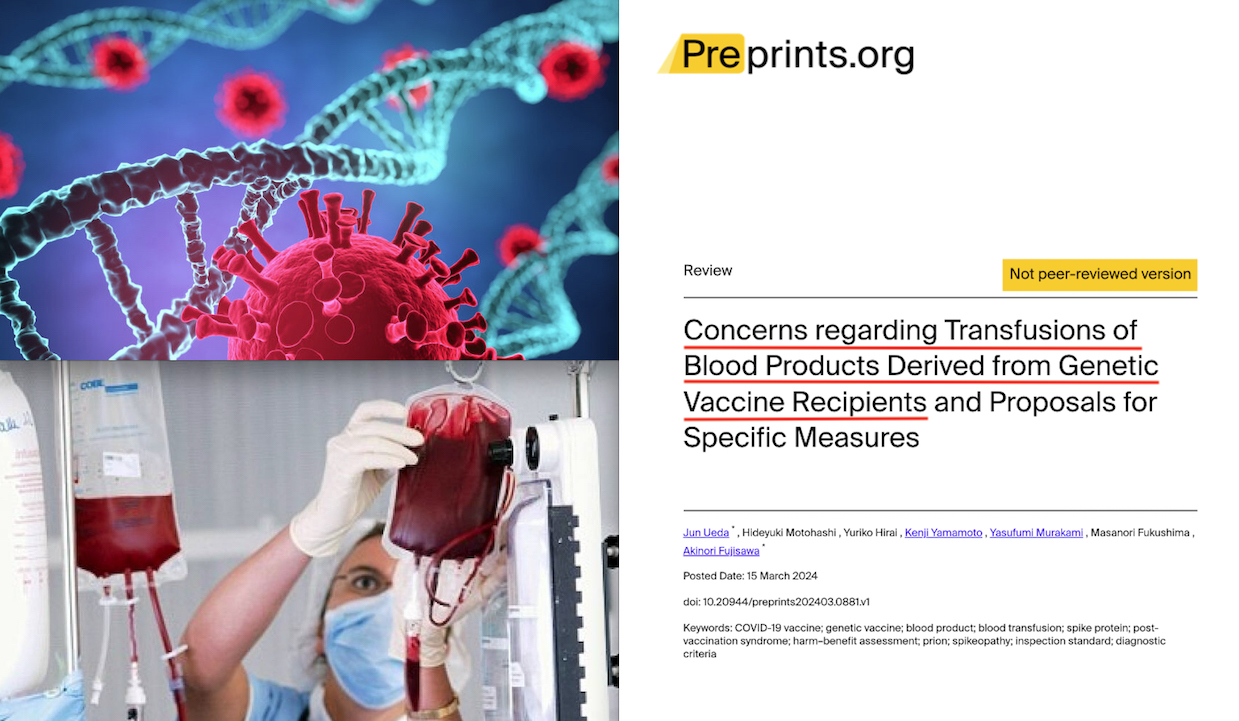 SOS DA OSPEDALI UNIVERSITARI GIAPPONESI: “TRASFUSIONI PERICOLOSE COL SANGUE DEI VACCINATI”. Studio sui Danni Cardiovascolari: “Fermate i Sieri mRNA“