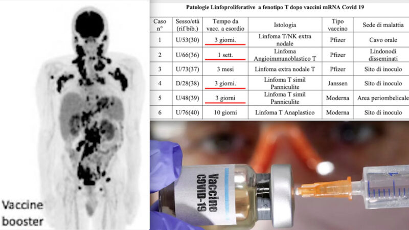 VACCINATI COVID: TURBO-CANCRO DOPO POCHI GIORNI-ORE! 26 Casi SHOCK in Studio di Oncologa Italiana sul Rischio Cancerogeno mRNA