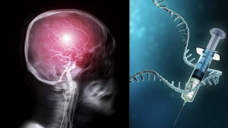 ALTISSIMI RISCHI DI TROMBI CEREBRALI DAI SIERI COVID. Studio Shock USA: 5.137 Casi in 3 anni! 200 volte tutti i Vaccini in 30 anni