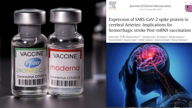 Studio Shock Giapponese: SPIKE TOSSICA DEI VACCINI COVID NELLE ARTERIE CEREBRALI DOPO ICTUS EMORRAGICI. Proteina “Killer” trovata 17 mesi dopo le Vaccinazioni